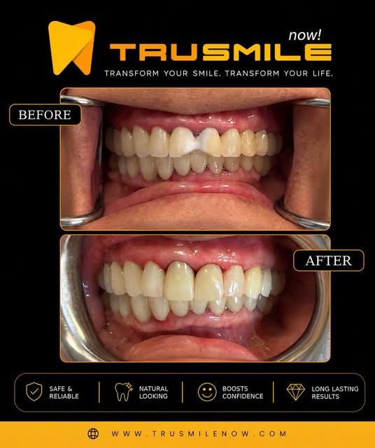 Instagram post by @trusmilenow